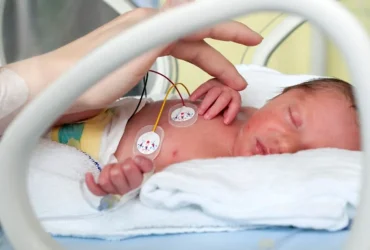 Kesehatan Bayi Prematur Perawatan Khusus